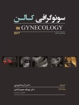 سونوگرافی کالن IN Gynecology 2017